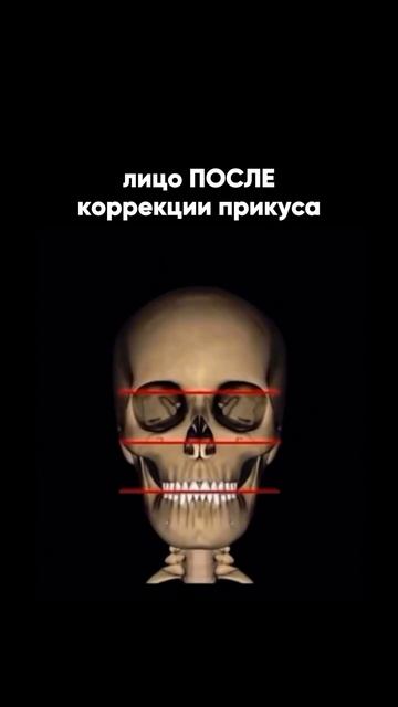 Брекеты — это не только про ровные зубы 😌