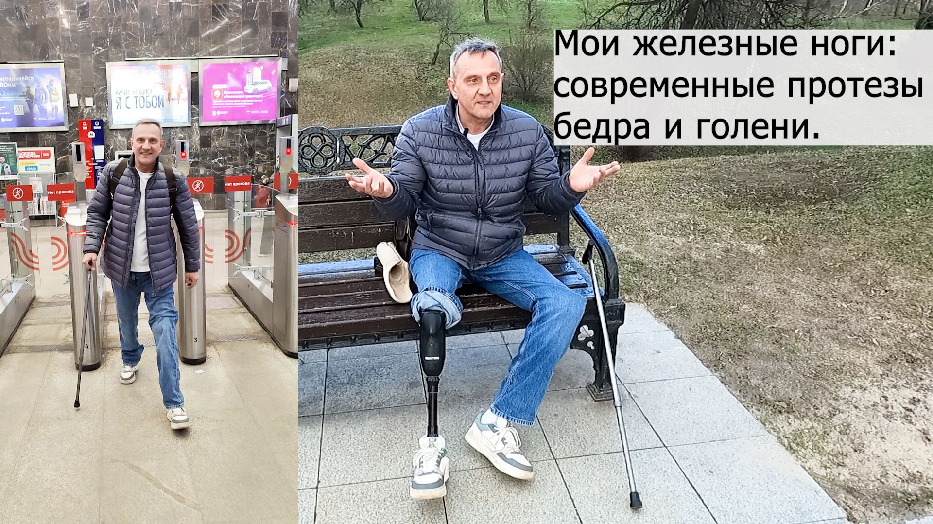 Мои железные ноги: современные протезы бедра и голени.