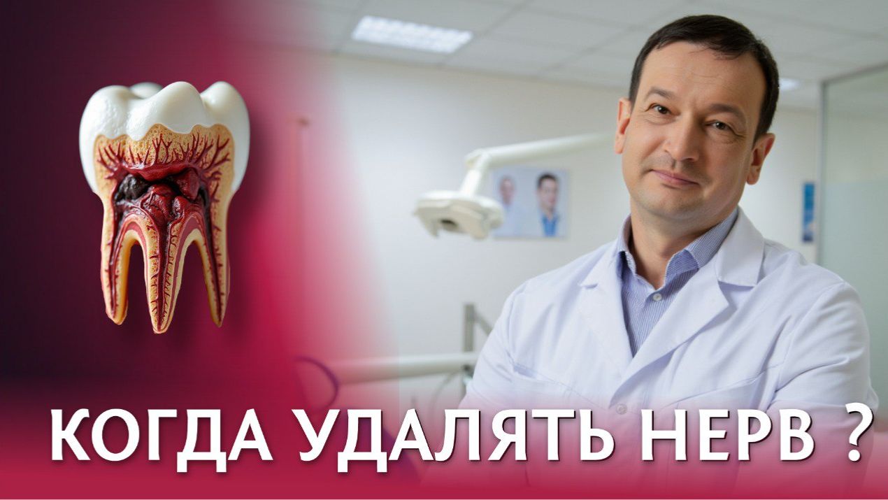 Когда удалять зубной нерв? // Причины и последствия удаления