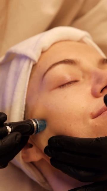 Кожа после, к которой не хочется добавлять фильтры.