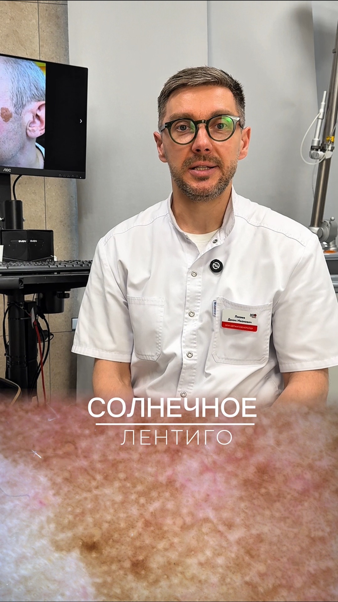 Солнечное лентиго / меланома юнит