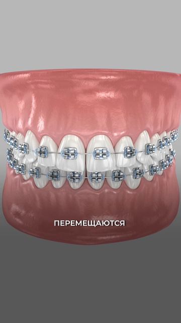 Как на самом деле двигаются зубы 🦷