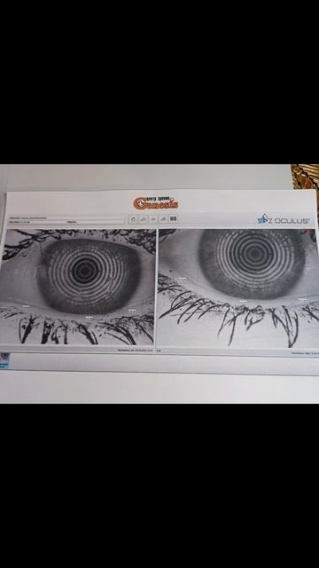 🌟 Комплексное обследование зрения в клинике «Генезис» (Симферополь)