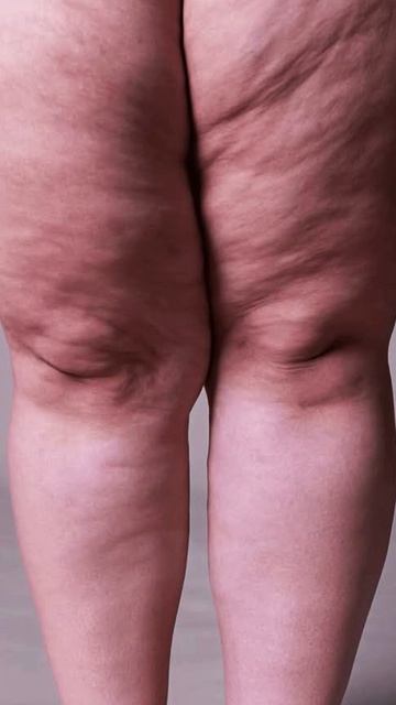 ДЛЯ ЧЕГО НУЖНЫ ПОЧКИ?