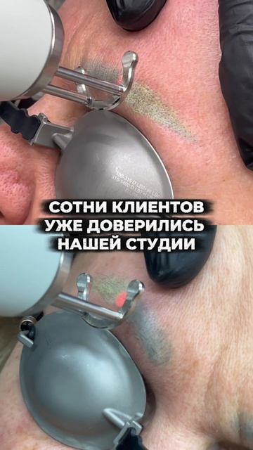 Хочешь избавится? Номер в шапке профиля 😊