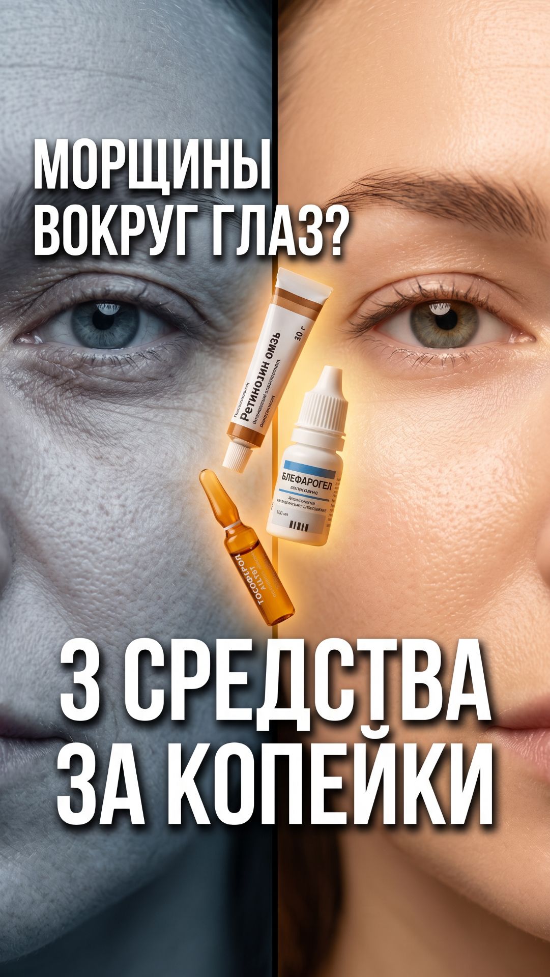 Морщины вокруг глаз не скрыть консилером — их нужно лечить 👁