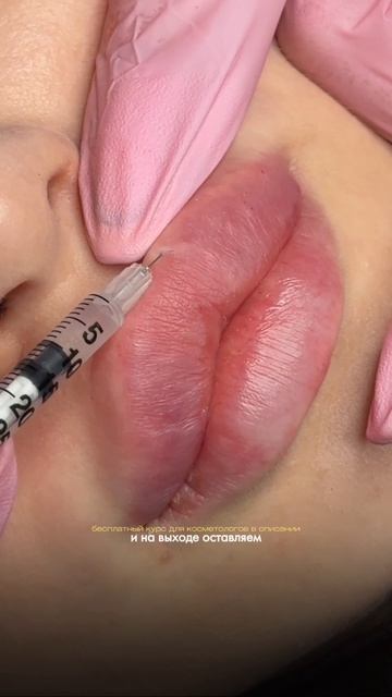 Как развернуть губы ботоксом