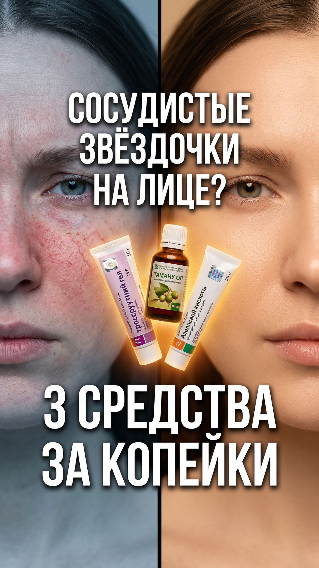 Сосудистые звёздочки на щеках и носу? 😬