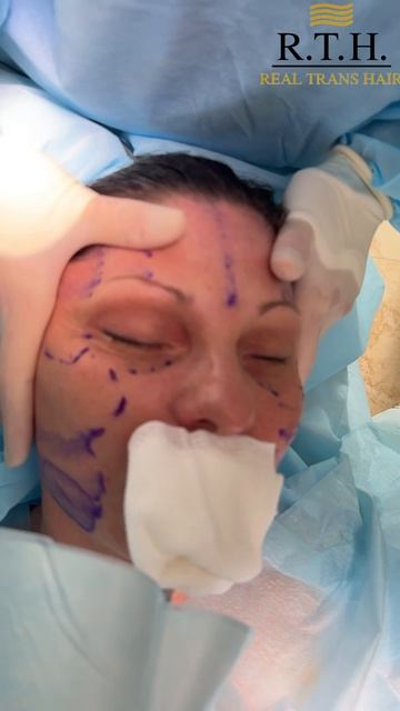 Комплексное оиоложение