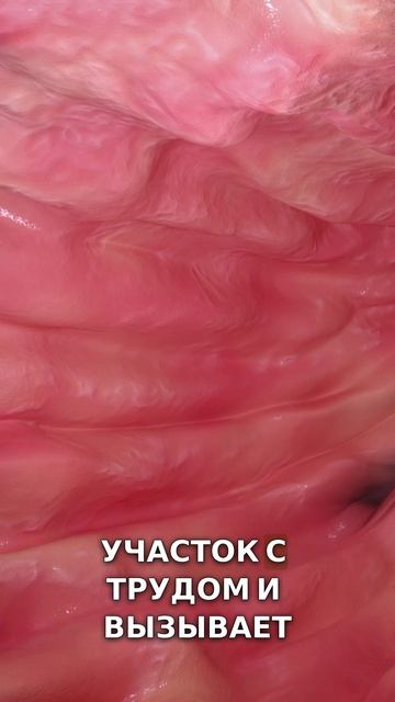 СТУЛ изменился