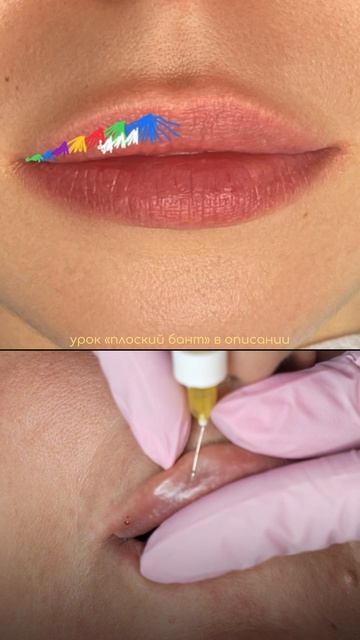 Увеличение губ в технике плоский бант