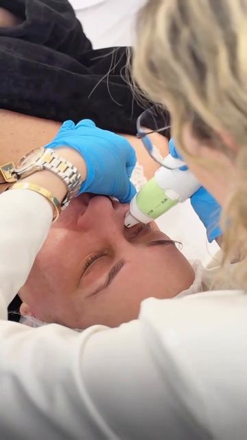 Прорыв в косметологии — RF-лифтинг на аппарате Volnewmer в «Бест Клиник»! 🌟