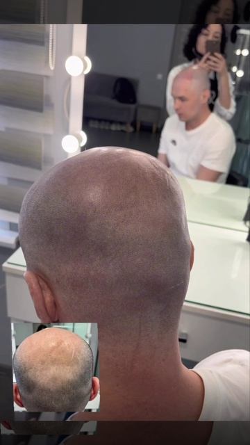 От облысения к прическе! Эффект бритой головы. И это только лишь второй сеанс 🔥