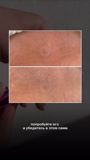 Крем омолодил на 30 лет 😱