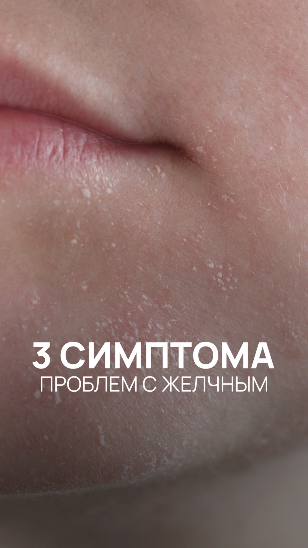 Три симптома, что у вас проблема с жёлчным👇🏻