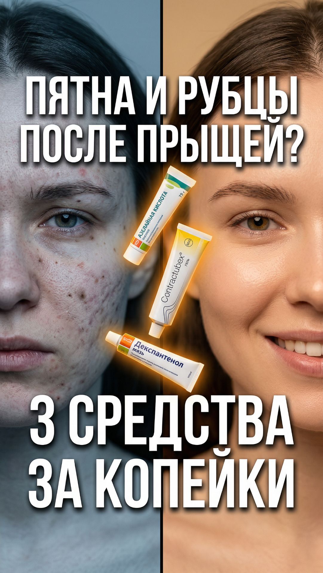 Прыщи прошли — а пятна остались? 😬