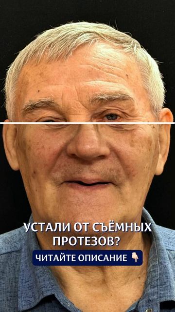 Устали от съемных протезов