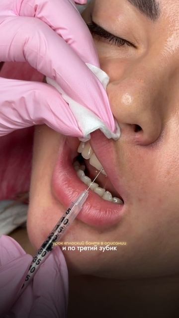 Как увеличить губы без боли?