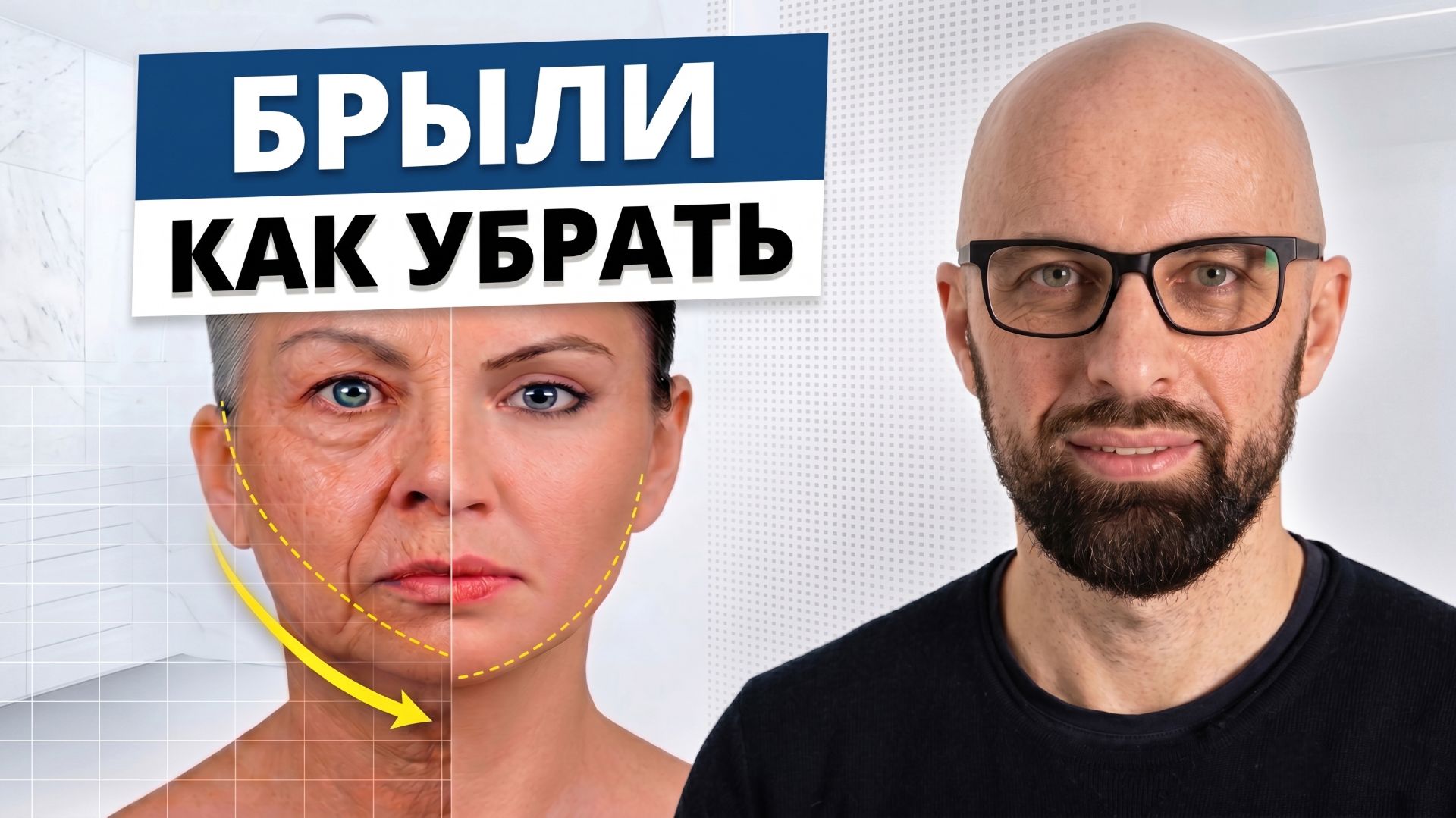 Брыли: почему кремы не работают? Фейслифтинг — вся правда от хирурга