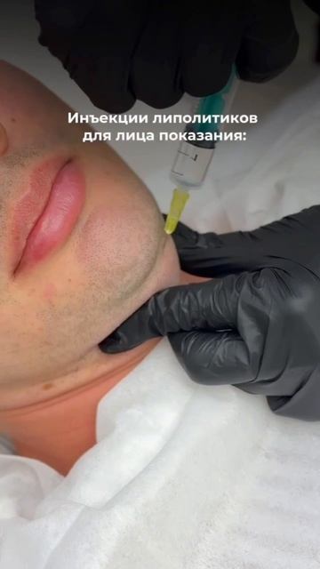 НЕПРЯМЫЕ ЛИПОЛИТИКИ