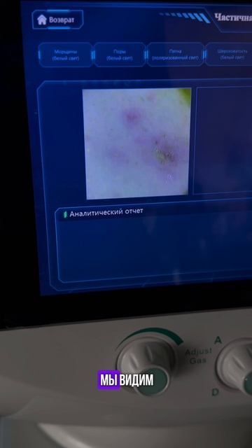 Почему анализатор кожи — Must-have в кабинете косметолога? 🤔