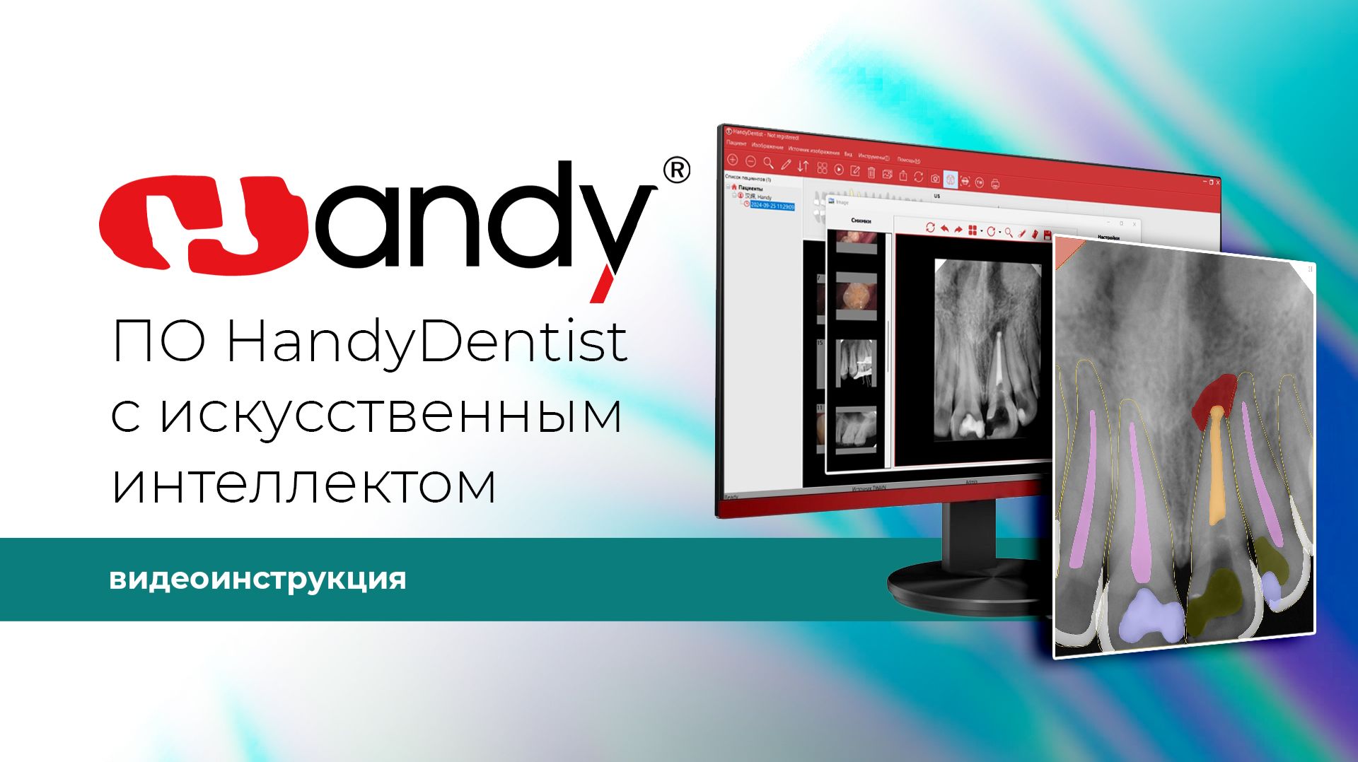 Видеоинструкция по использованию ПО HandyDentist с искусственным интеллектом
