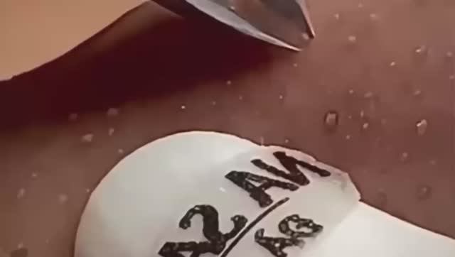 #262 Чистка лица от угрей и акне. Выдавливание прыщей. Удаление черных точек и комедонов