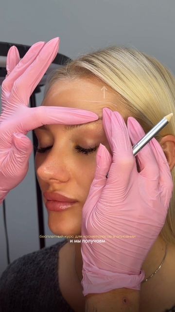 Лифтинг бровей ботоксом