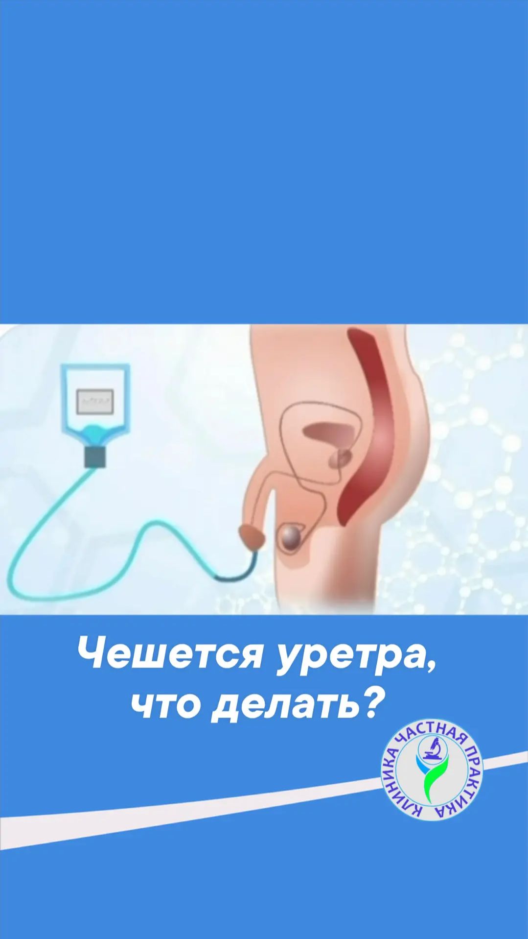 Чешется уретра. Что делать?