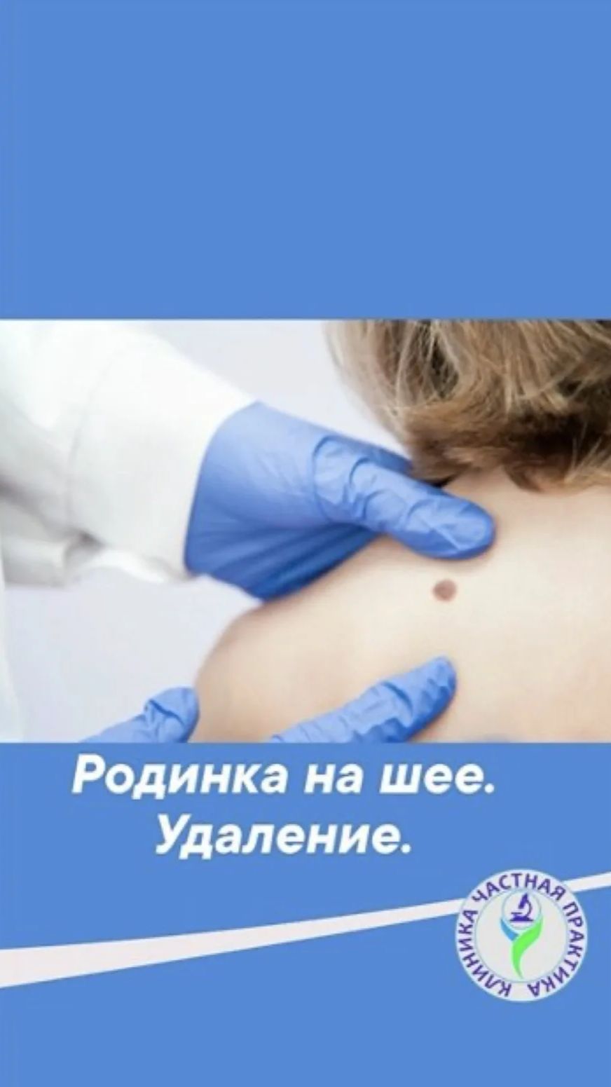 Родинки на шее