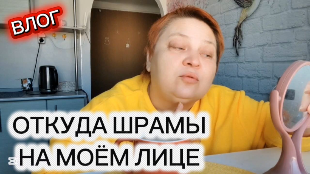 Про моё ТЯЖЁЛОЕ ДЕТСТВО 💯 ВЫЖИЛА, но остались шрамы!