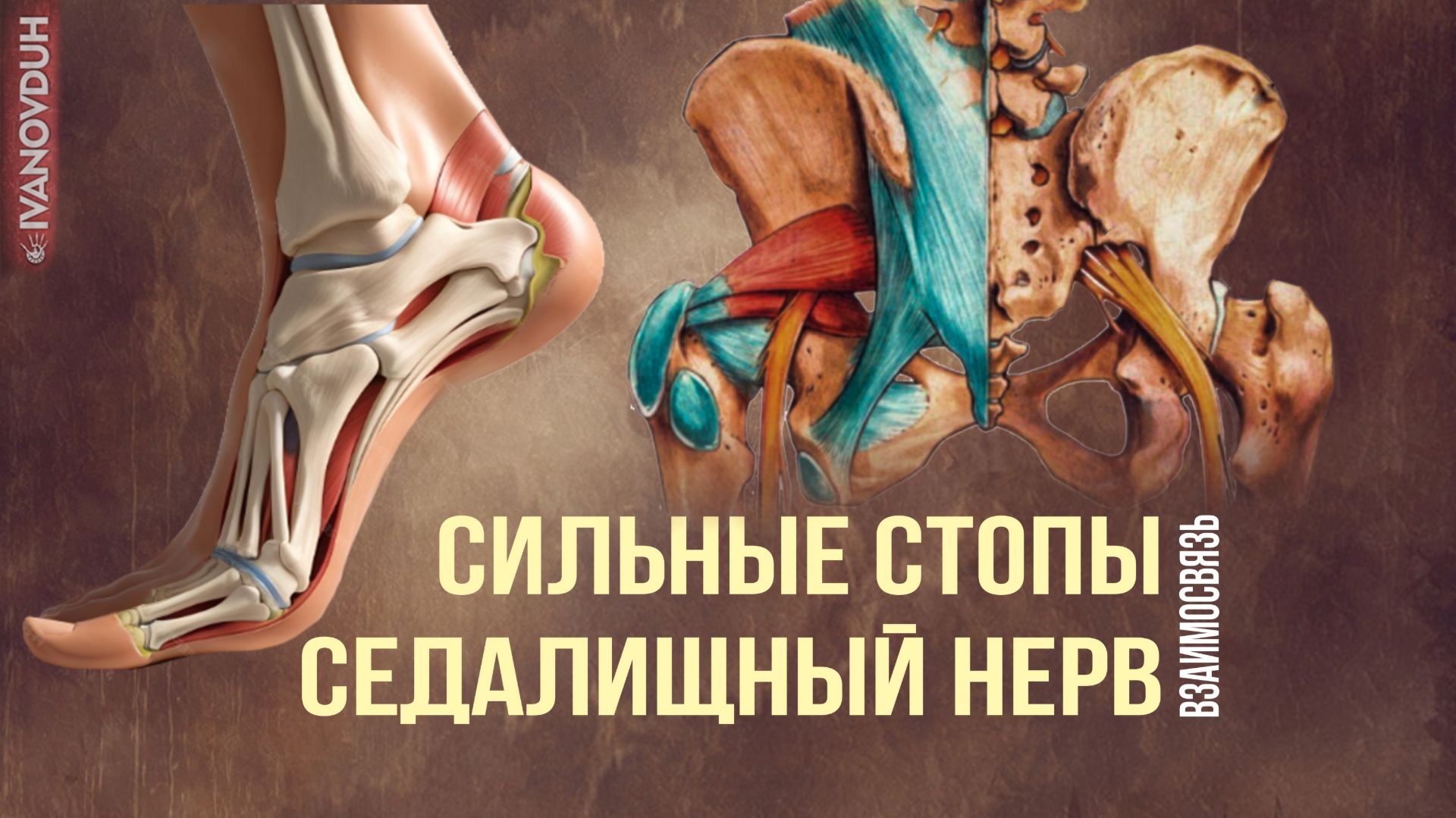 СИЛЬНЫЕ СТОПЫ и СЕДАЛИЩНЫЙ НЕРВ
