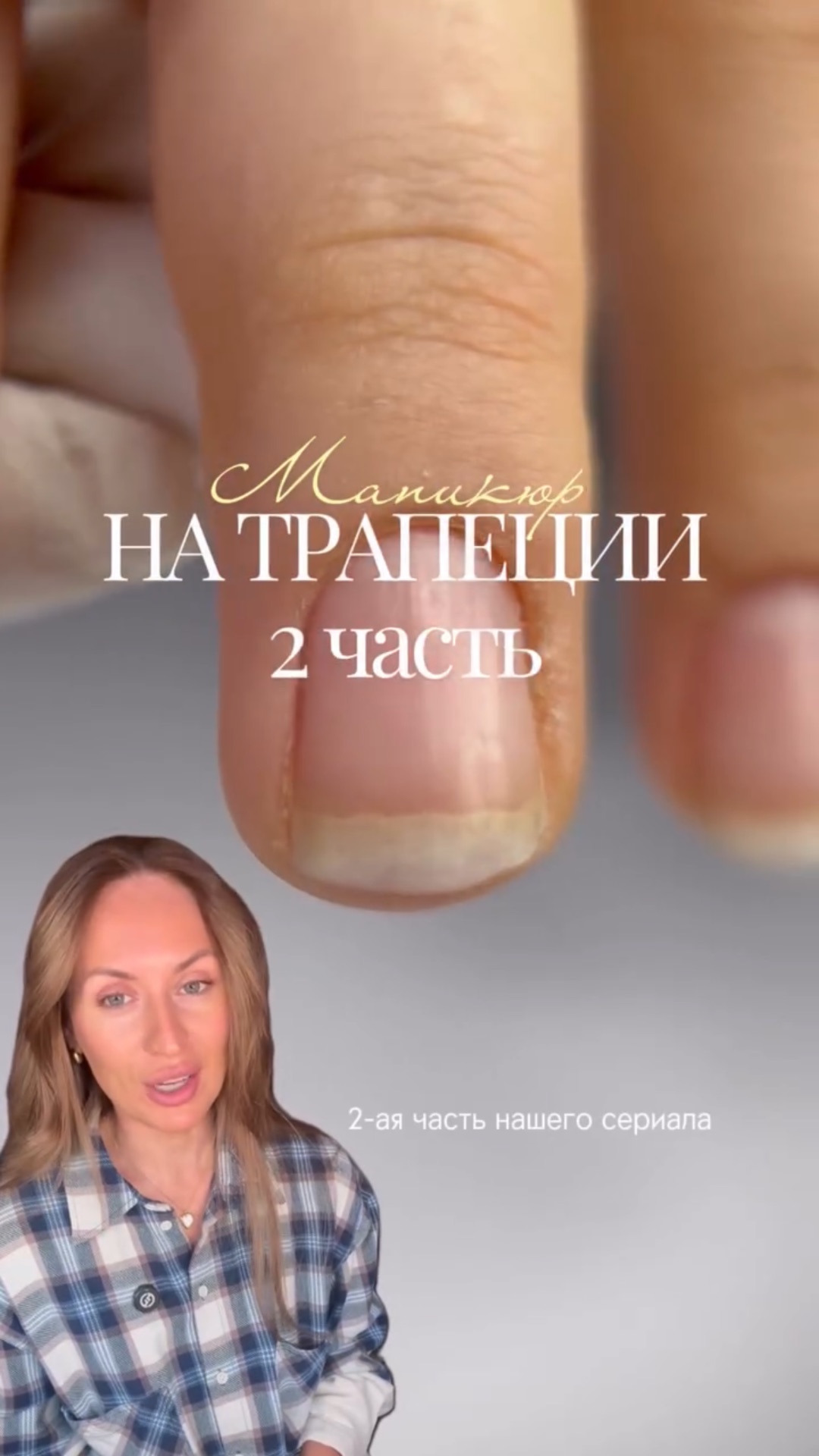 Как сделать клиентское укрепление на трапецию❓