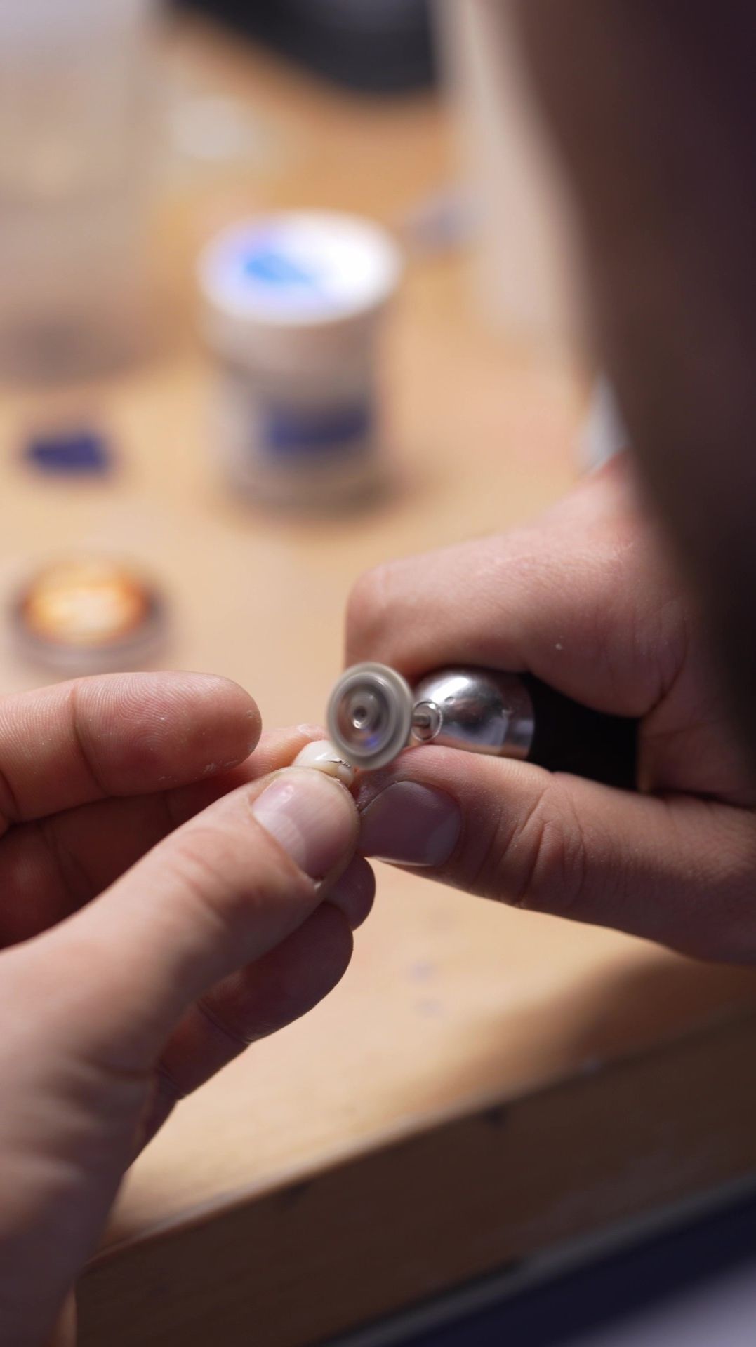 Сколько на самом деле служат виниры?