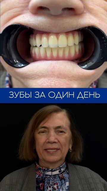 Кейс пациента