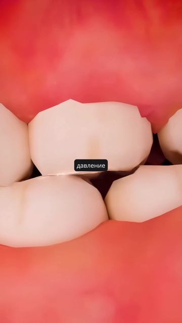 Вот что будет если не лечить глубокий прикус