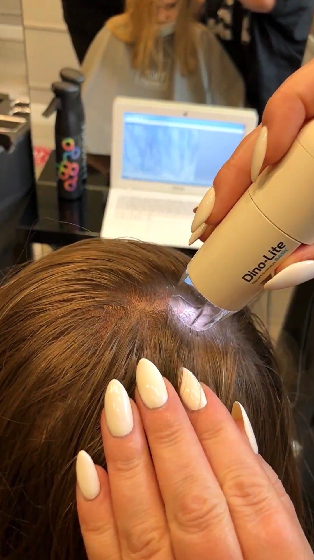 Процедура мягко отшелушивает ороговевшие клетки, очищая и обновляя кожу головы.