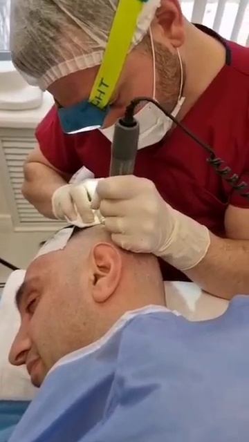 Процесс пересадки волос