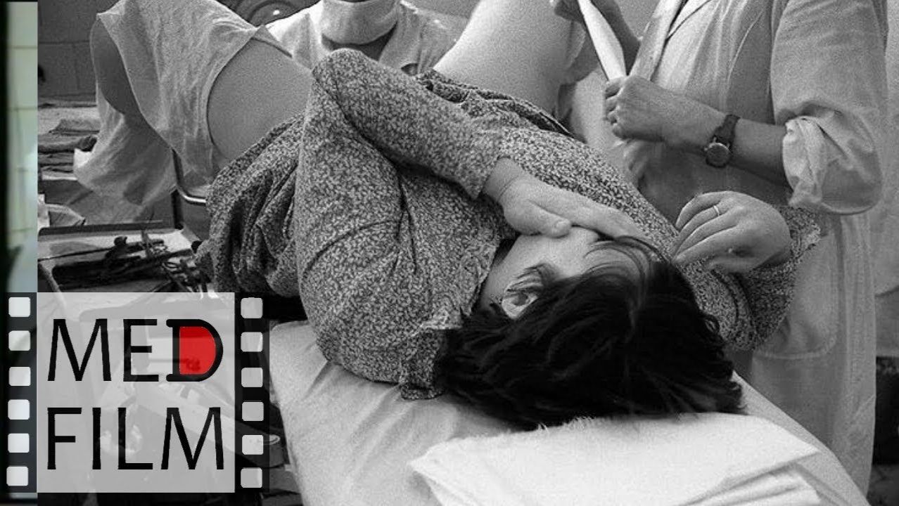 2. Тазовое предлежание ©