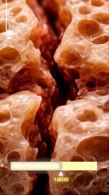 Как заживают кости