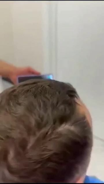 Удаление родинки у врача Туби Аюбовой в нашей клинике Venus Estetika, часть 2