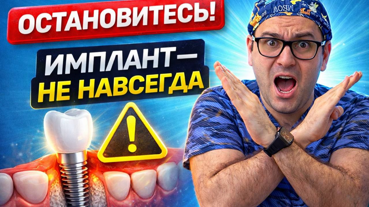 Имплант не приживется? 7 причин ,о которых вам НИКТО НЕ говорит