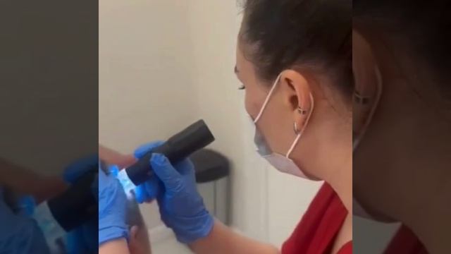 Удаление родинки у врача Туби Аюбовой в нашей клинике Venus Estetika, часть 1