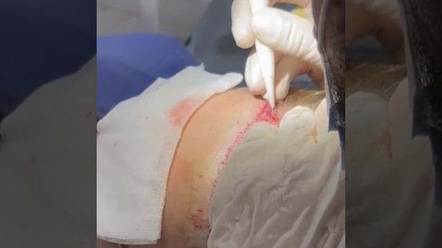 Venus Estetika - Клиника пересадки волос в Москве