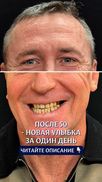 Кейс пациента