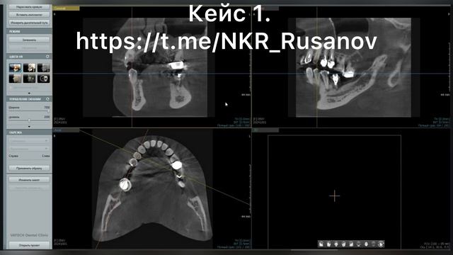 НКР 1.1.1 Исходная ситуация