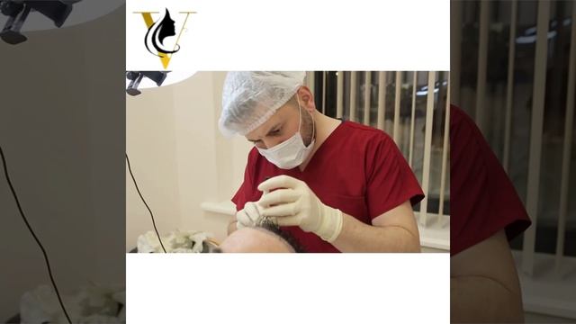 Пересадка волос в  Venus Estetika