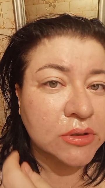 Наглядный отзыв на патчи с микроиглами.