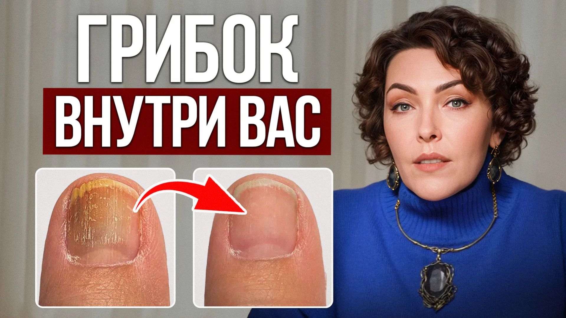 ЭТО убирает грибок ногтей лучше мазей! / РЕЦЕПТ волшебной смеси из эфирных масел