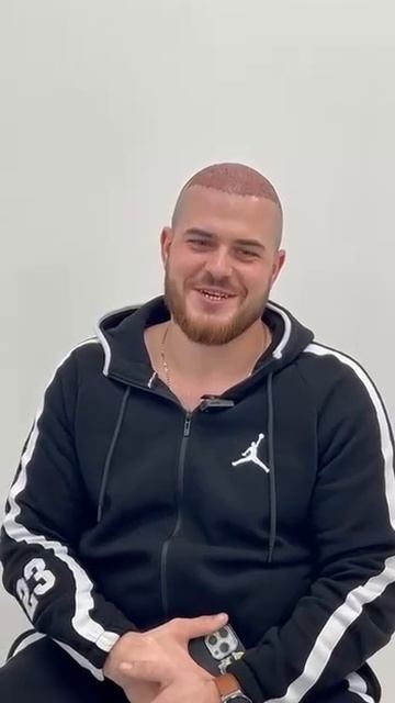 Отзыв о пересадке волос